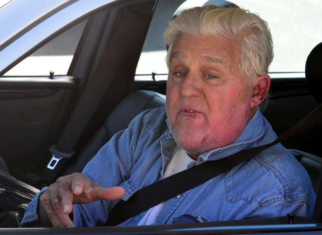 Jay Leno's Remarkable Recovery